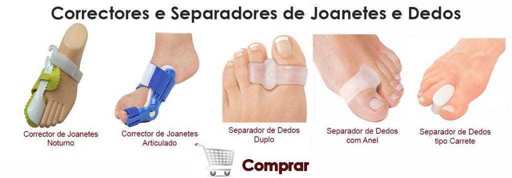Joanetes - Hallux Valgus - Joanete do 5º dedo. Saiba mais aqui.